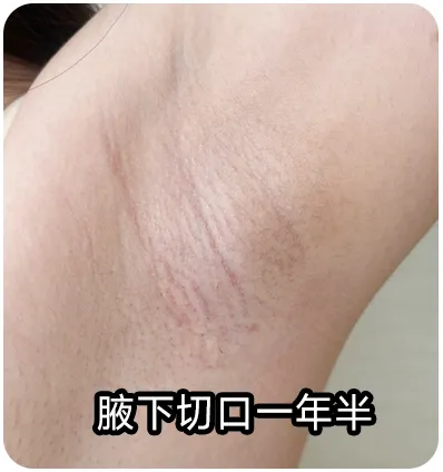 不靠大胸赢麻了!韩国INS爆红小姐姐,极致比例身材美到犯规 不靠大胸赢麻了!韩国INS爆红小姐姐,极致比例身材美到犯规