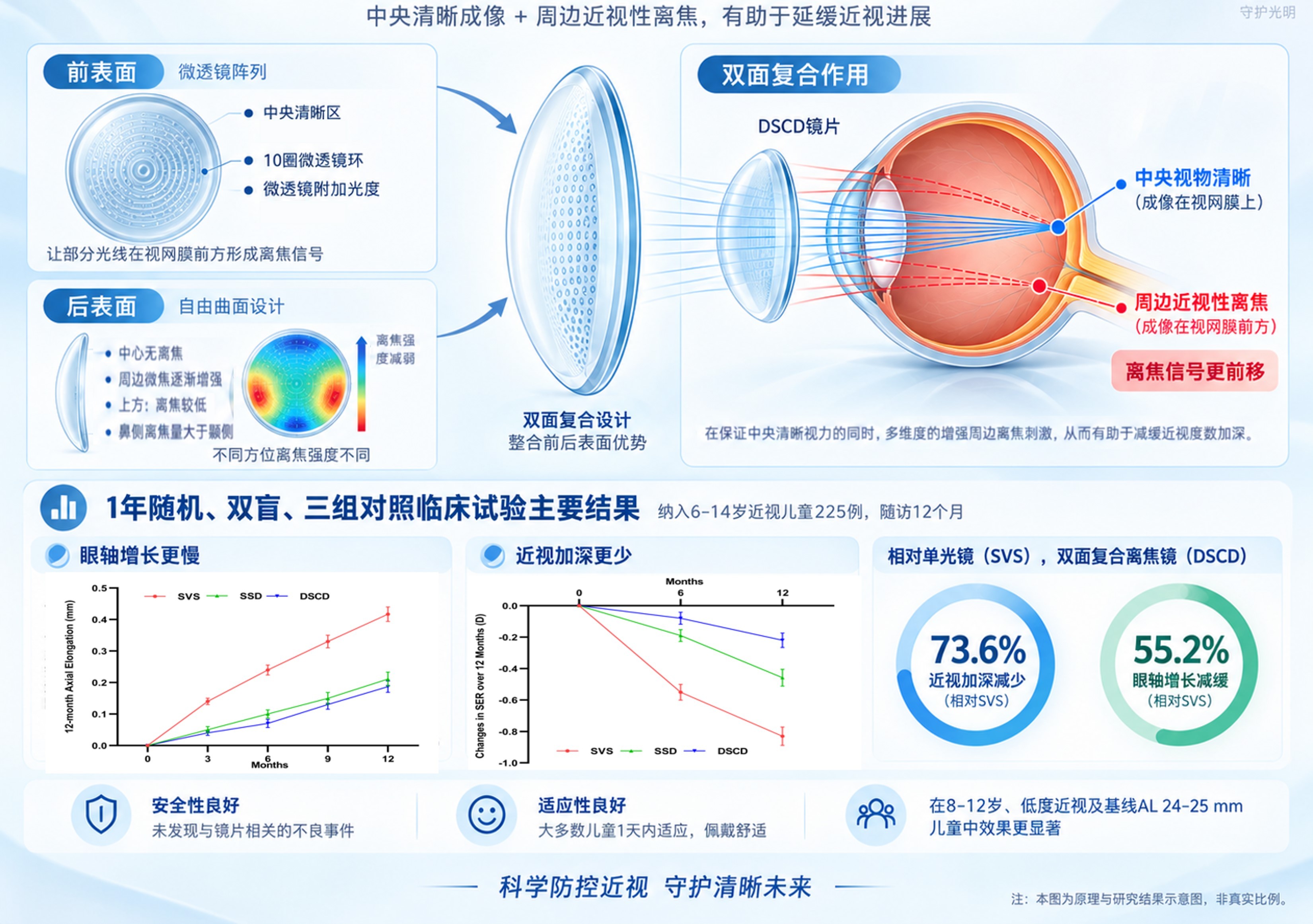 北京同仁医院团队发表研究:双面复合离焦镜片探索儿童近视控制新路径 北京同仁医院团队发表研究:双面复合离焦镜片探索儿童近视控制新路径
